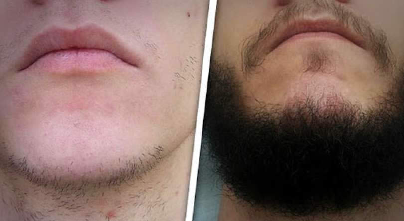 14 maneras de hacer crecer tu barba